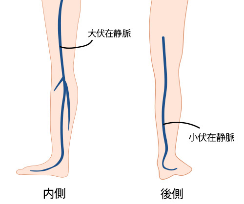 下肢静脈瘤で手術適応となる主な静脈の位置