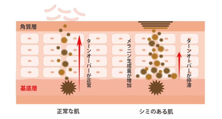 メラニンとは何ですか?